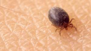 Tick crawling on skin 2