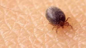 Engorged Tick Crawling on Skin
