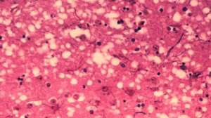 Histology bse e1528315181393