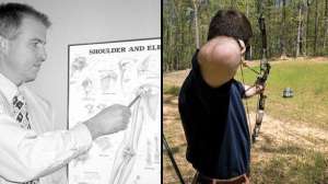 Archery injury shoulder 1 august lead 181003 160706